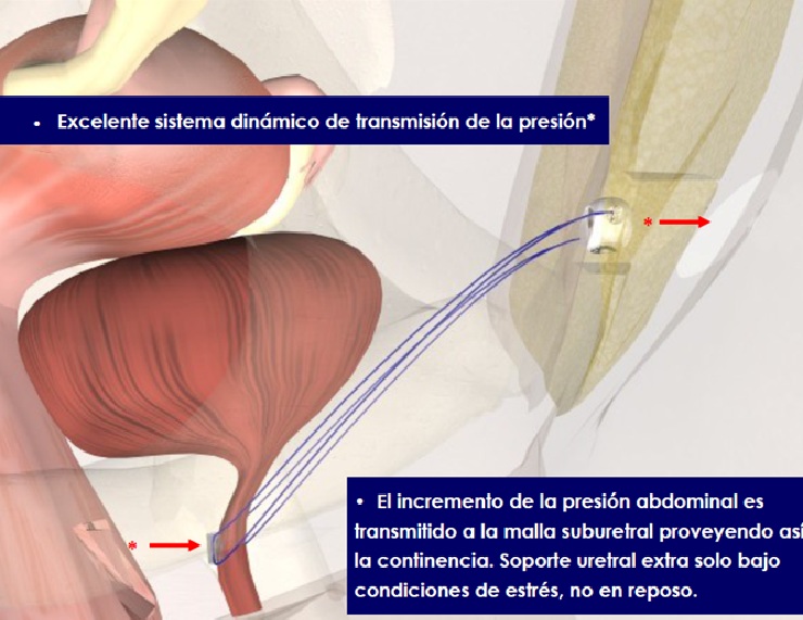 TRT REMEEX FEMENINO - Imagen 2